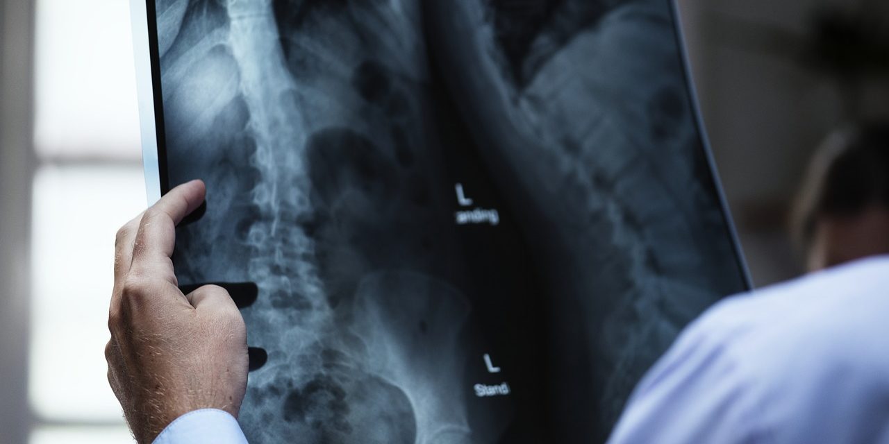 conventional_xray_imaging