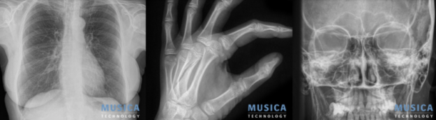 MUSICA_röntgenkuvia_artikkelikuva_web