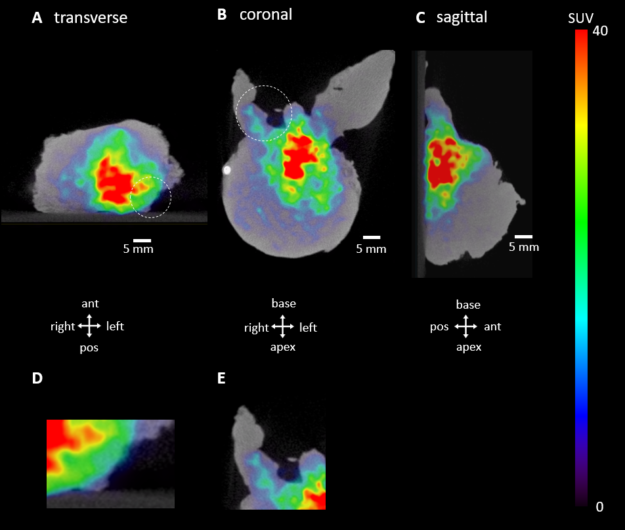 Prostate_Cancer_Aura10_2_2023-02_Figure-1
