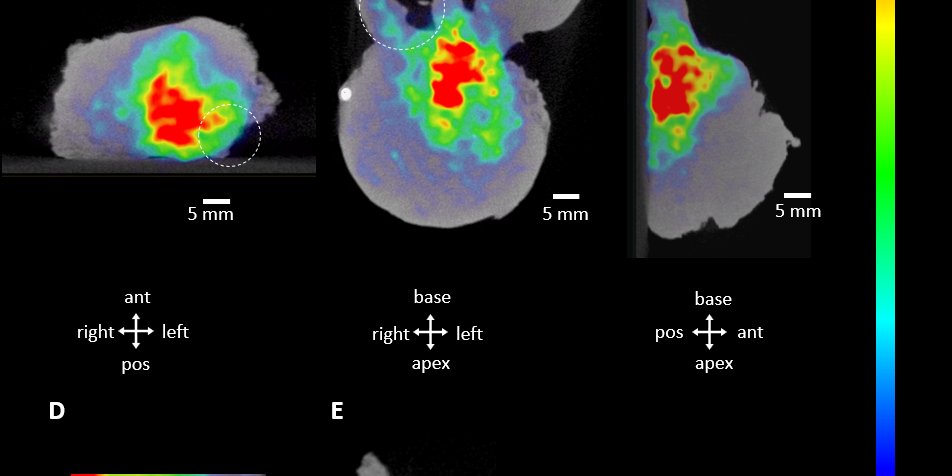 Prostate_Cancer_Aura10_2_2023-02_Figure-1