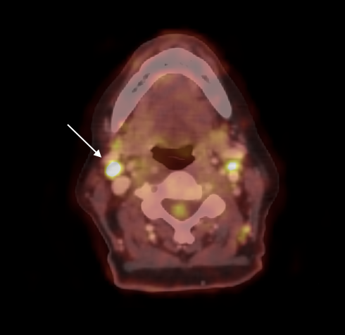 Case 13 FIG1_2024-02-21-083546_msvp